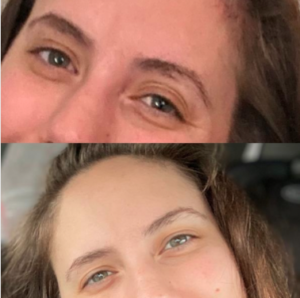 סרום עיניים לטיפול בכהויות ושקיות מתחת לעיניים photo review